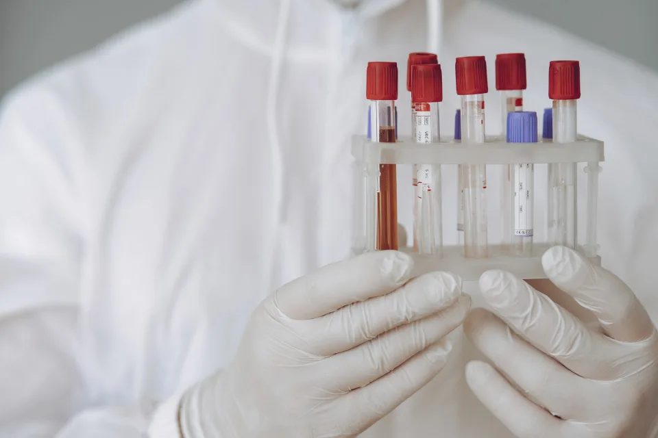 Бельгійські експерти визнали тести на PFAS непридатними для медичної діагностики